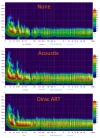 acoustix-and-dirac-art-comparison-graphs-v0-8plamp7sd6eg1.webp
