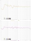 Measurements Before & After.jpg