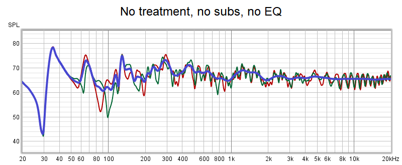 ASR 310 750 MA1 - ohne alles L R Av.png