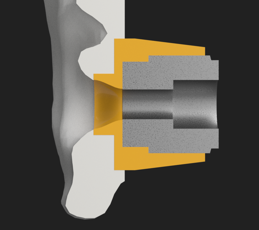 ear_coupler_render_demo.png